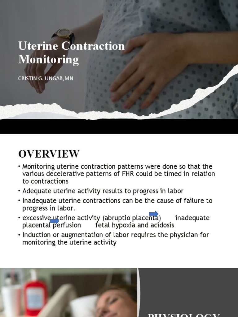 Monitoring Uterine Contractions PDF Uterus Childbirth