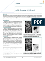 Scintigraphic Imaging of Splenosis
