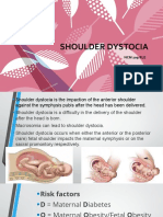 Shoulder-dystocia Edited (1)