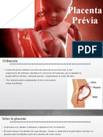 Placenta Prévia - 2021