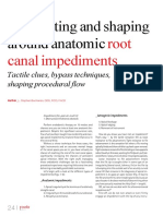 Root Canal Impediments: Negotiating and Shaping Around Anatomic