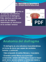 Hernia Diafragmatica