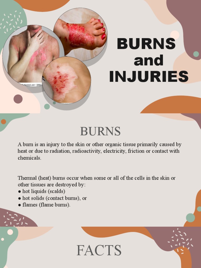 Understanding Burn Injuries and Treatments | PDF | Burn | Wound