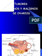 Tumores Benignos y Malignos de Ovario 1228447832478194 8