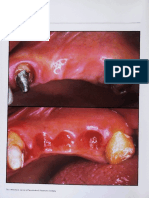 Tissue Response Under Hyperpressure