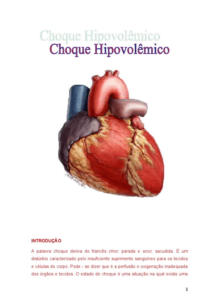 Choque Hipovolêmico: Causas e Tratamento | PDF | Choque (circulatório ...