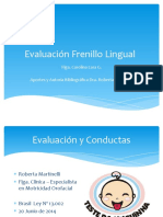 Frenillo Sublingual HDII