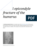 Medial Epicondyle Fracture of The Humerus - Wikipedia