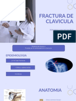 Fractura de Clavicula 