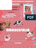 Hidrocefalia