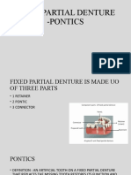 Fixed Partial Denture - Pontics: G.Rachana Intern