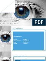 BST Blefaritis Posterior