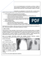 Derrame Pleural