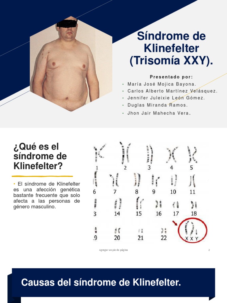 Síndrome de Klinefelter (Trisomía XXY) | PDF | Especialidades Medicas ...