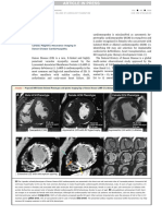 Imail: Cardiac Magnetic Resonance Imaging in Danon Disease Cardiomyopathy