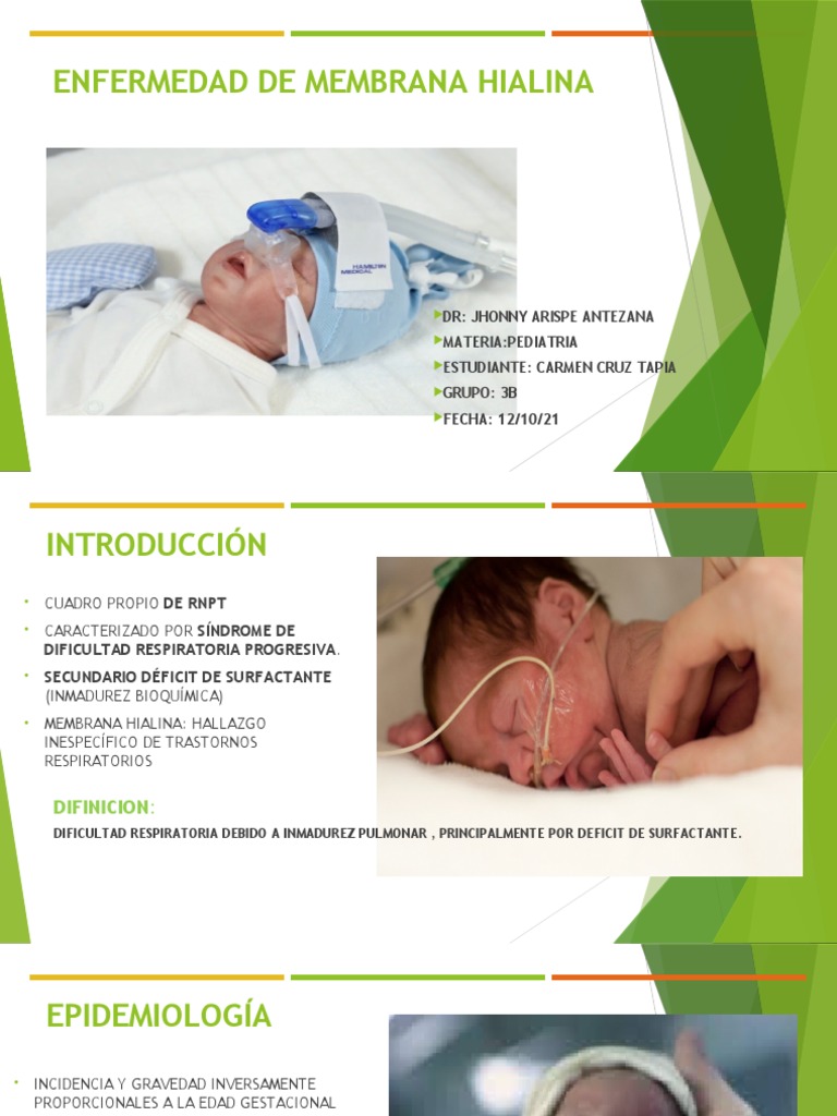 Enfermedad de Membrana Hialina PDF Pulmón