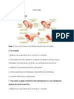 Tipos de Parto