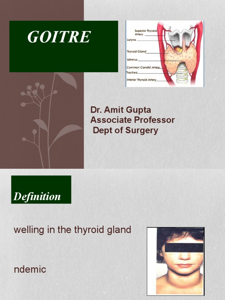 Goitre Dr Amit Gupta Associate Professor Dept Of Surgery Pdf