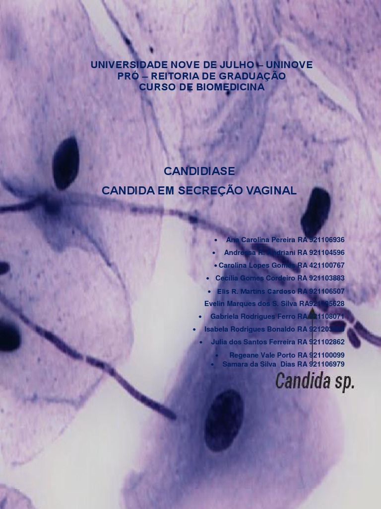 Candidíase em Secreção Vaginal | PDF | Candidíase | Infecção