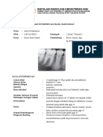 Interpretasi Dense Bone Island - 160110180035 - Aliyya Rifqunnisa