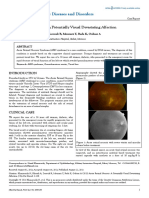 Acute Retinal Necrosis A Potentially Visual Devastating Affection