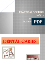 Practical of Dental Caries (2017)