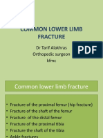 Common Lower Limb Fracture: DR Tarif Alakhras Orthopedic Surgeon KFMC