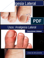 Analgesia Lateral