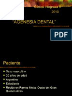 Agenesia Dental, Caso Clinico