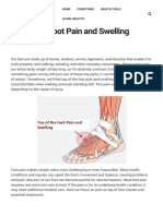 Top of The Foot Pain and Swelling Treatment