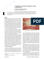 Onlay Partial Denture Technique For Assessment of Adequate Occlusal Vertical Dimension: A Clinical Report