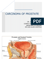 Carcinoma of Prostate: Dr. Saadat Hashmi Consultant Urologist