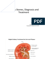 SURGERY Kidney Stones Even 04-06-21