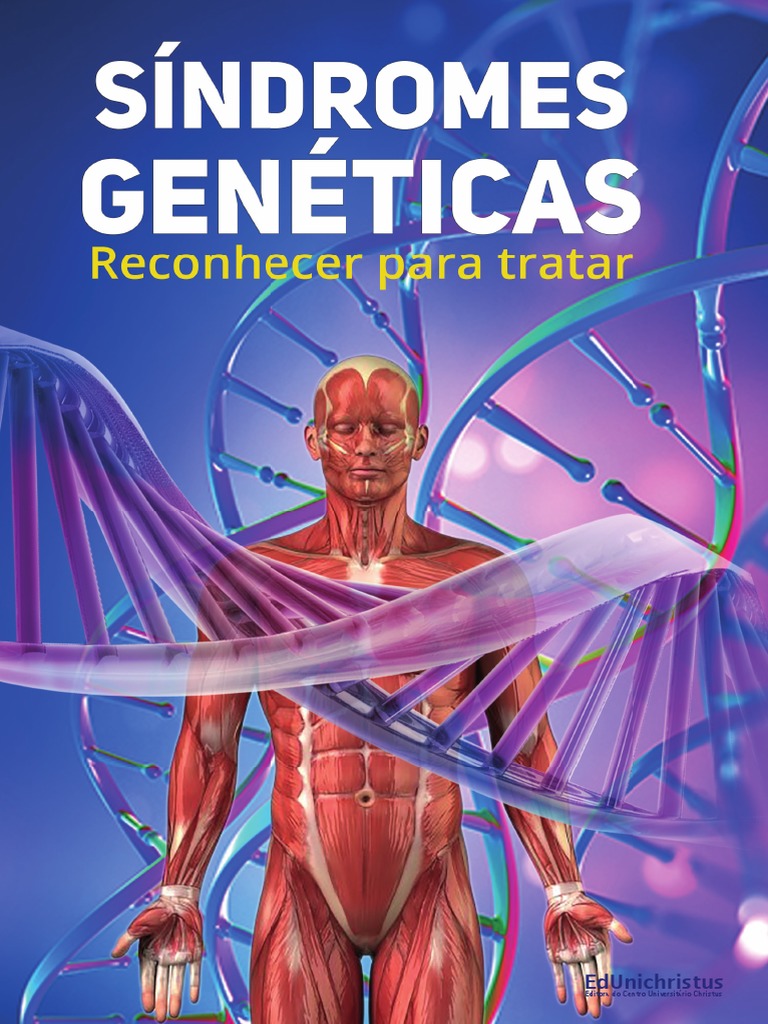 Síndromes Genéticas Reconhecer para Tratar | PDF | Genética ...