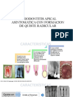 Periodontitis Apical Asintomatica Con Formacion de Quiste Radicular