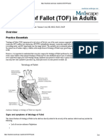 TOF in Adult