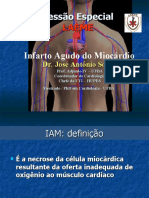 Infarto Agudo do Miocárdio: Definição, Fisiopatologia e Abordagens Terapêuticas
