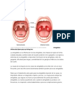 Trastorno Bipolar