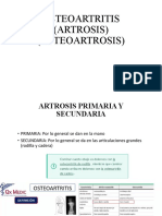 OSTEOARTRITIS (ARTROSIS)