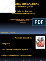 Echographie Thyroidienne Dr Rouquette