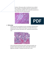 Papilloma Benign Melanoma