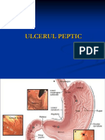 5.ulcerul Peptic