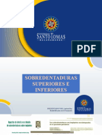 Sobredentaduras Superiores Inferiores