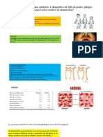 Criterios Diagnosticos