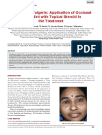 Pemphigus Vulgaris Case Report: Occlusal Splint and Topical Steroid Treatment