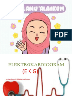 Ekg