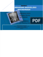 Dokumen - Tips - Gambaran Radiologi Invaginasi DR Pherena Amalia SP Rad 5616b4b0ba0e3