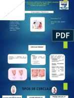 Cerclaje Uterino