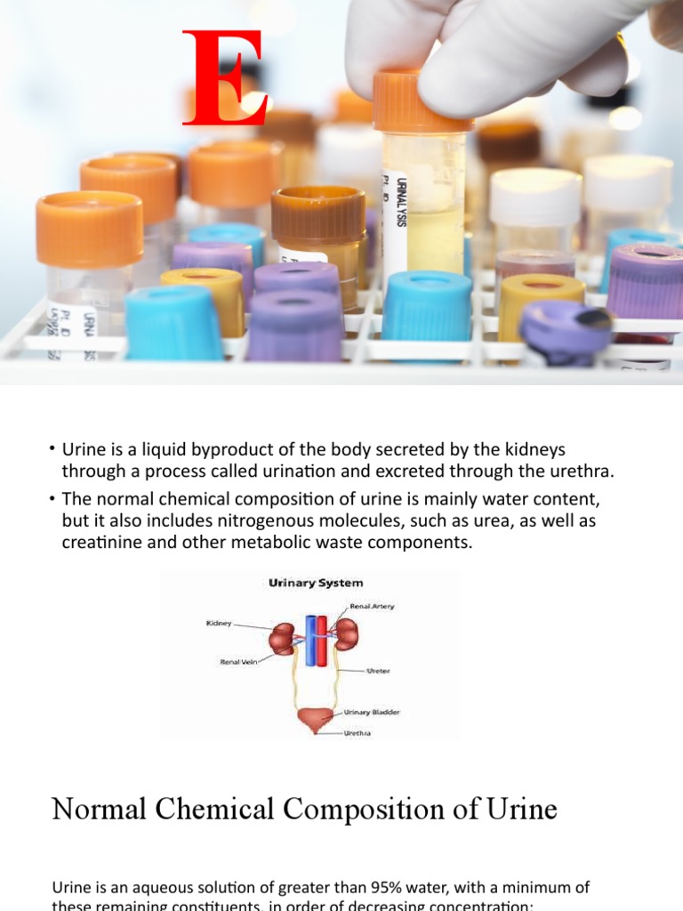 Understanding Urine Composition and Types | PDF