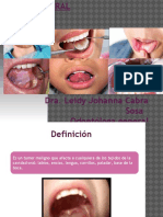 Presentación cáncer oral